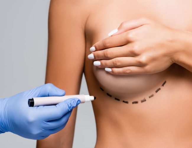 Cómo mejorar la firmeza de los senos tras el embarazo sin cicatrices